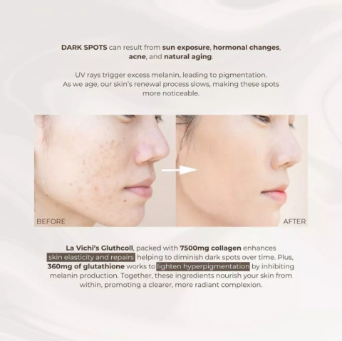 La Vichi Gluthcoll "Super White & Glow" 7-28 Days Treatment - Gambar 4
