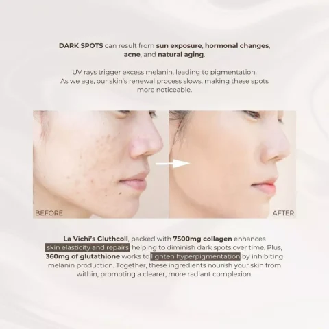 La Vichi Gluthcoll Collagen “30 Days Treatment” Fish Collagen Low Molecular 300 Dalton - Gambar 4
