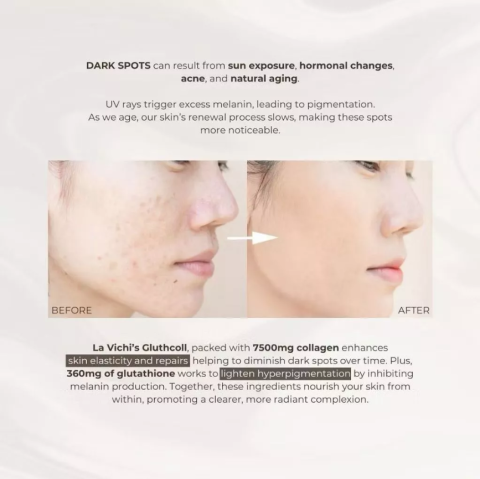 La Vichi Gluthcoll 3 Months Treatment "Super White & Glow" - Gambar 4
